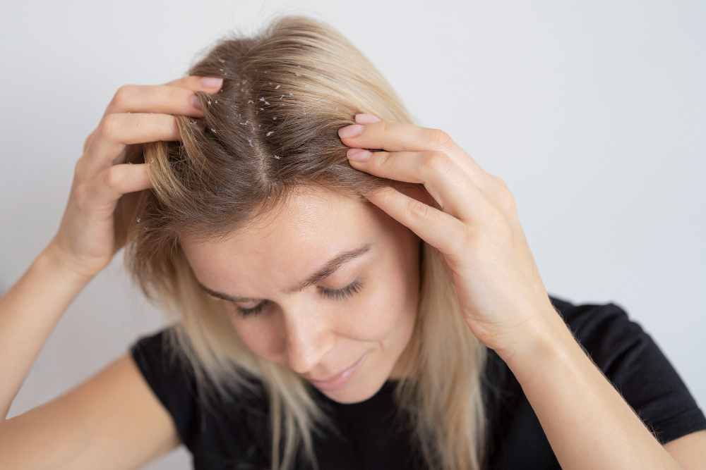 Neem oil for dandruff treatment